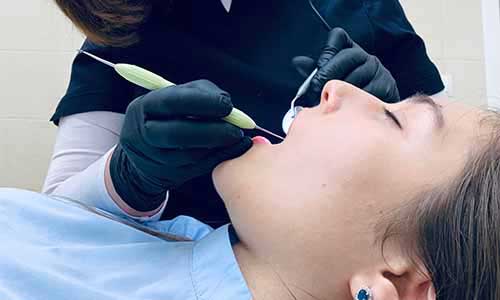 Dental Implants in Buford, GA
