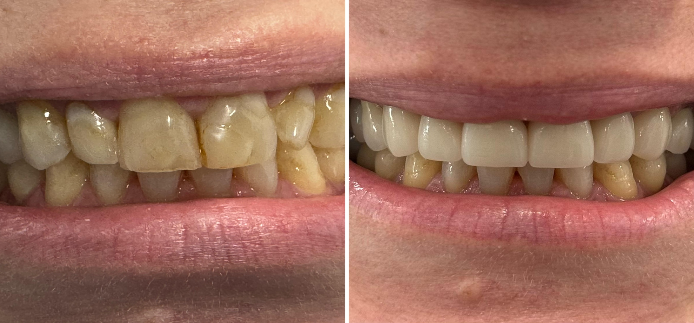 Family & Cosmetic Dentist in Buford, GA