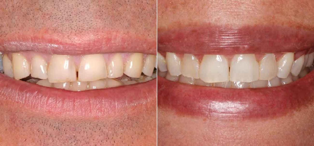 Family & Cosmetic Dentist in Buford, GA